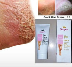 Soapex Heel Cream Soapex