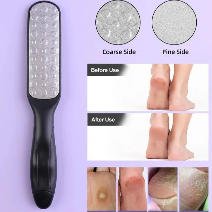 Sweet Beauty Plastic Handle Foot Callus Remover Sweet Beauty