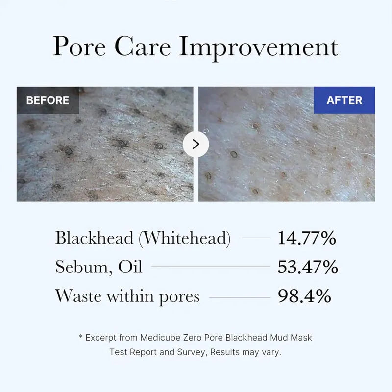 Medicube Zero Pore Blackhead Mud Mask  - 100g - Free Applicator Medicube