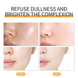Dr.Rashel Acne Remover Stick with Tea Tree Oil A Beautiful Magic Stick - 7g