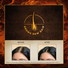 Indulekha Bringha Hair Oil - 100ml Indulekha