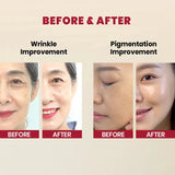 KSecret - Seoul 1988 Serum: Retinal Liposome 2% + Black Ginseng - 30ml