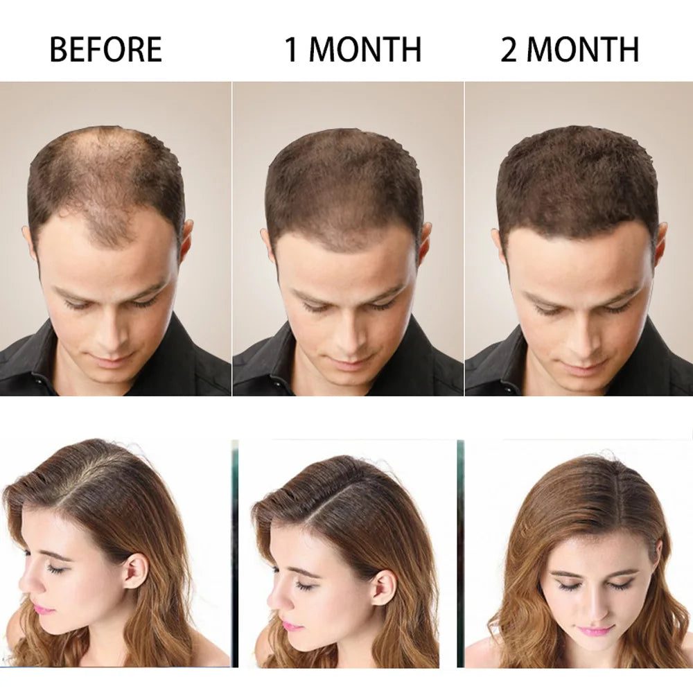 Disaar Hair Shampoo Anti-Hair Loss - 200ml Disaar