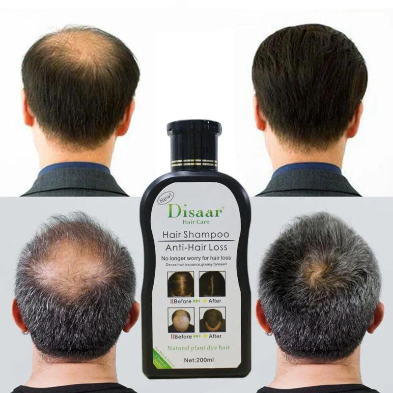 Disaar Hair Shampoo Anti-Hair Loss - 200ml Disaar