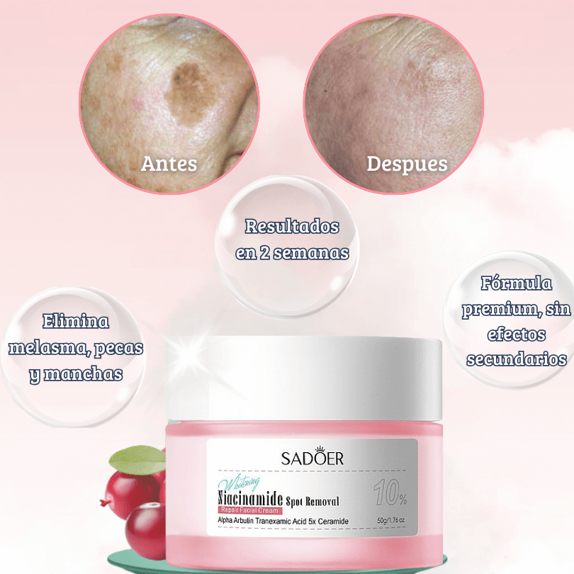 Sadoer Niacinamode Spot Remover Repair Cream 50g Sadoer