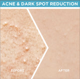 Garnier Skin Active Fast Clear Booster Serum For Acne Prone Skin
