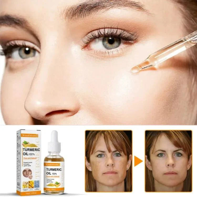 Turmeric Remove Dark Spots Essential Oil Cosmia.pk