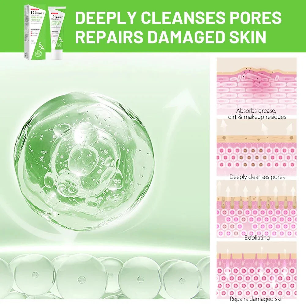 Disaar ceramide Anti-Acne Facial Gel Moisturizing Face Gel - 30g Disaar