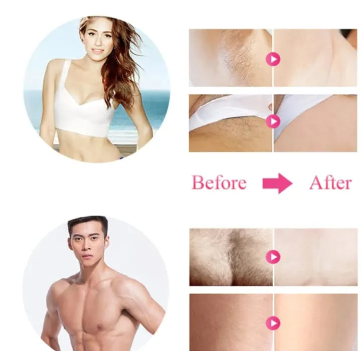 Babyverse IPL Laser Epilator Women Laser Hair Removal Babyverse