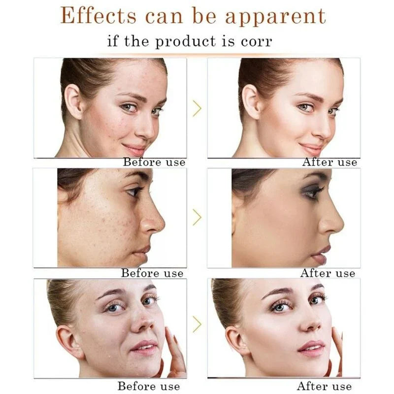 Bioaqua Avocado Moisturizer-Face Whitening Cream - 50gm Bioaqua