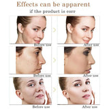 Bioaqua Avocado Moisturizer-Face Whitening Cream - 50gm