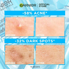 Garnier Bright Complete Anti-Acne Cleansing Foam - 100ml. Garnier