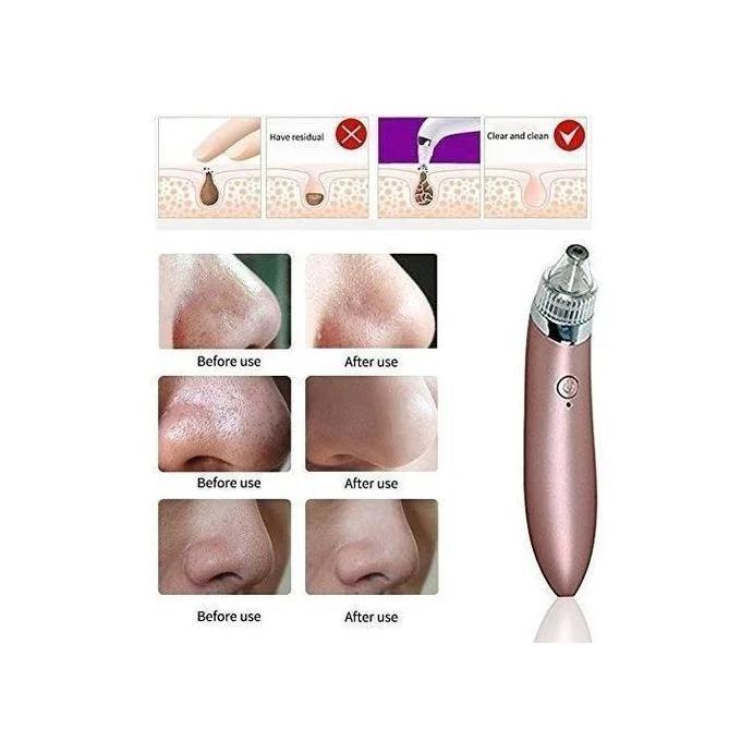 Electric Blackheads Remover Beauty Tool Cosmia.pk
