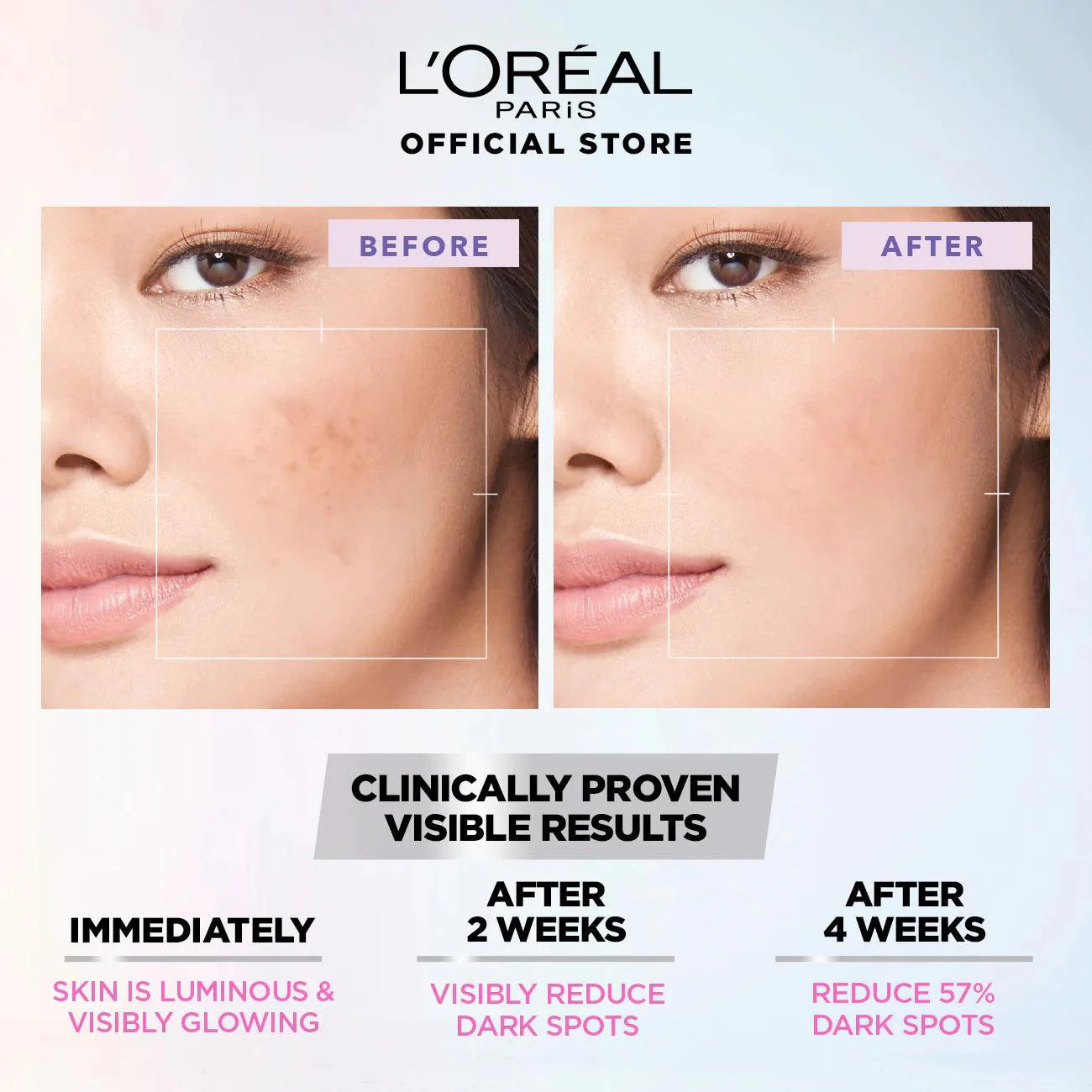 Loreal Paris Glycolic Bright Instant Glowing Serum Mask Loreal Paris