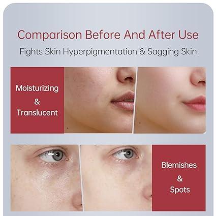Zooson Freckle Cream Tube Zooson