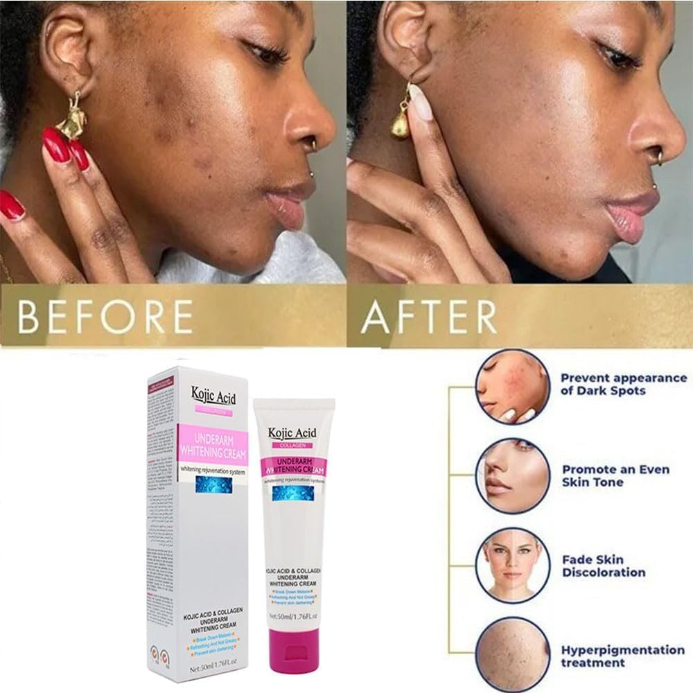 Guanjing Kojic Acid & Collagen Underarm Whitening Cream – 50ml Guanjing