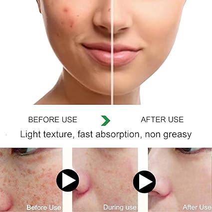 Zooson Freckle Cream Tube Zooson