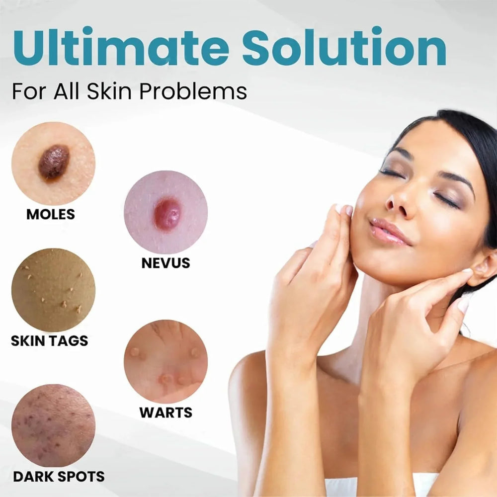 Non-Invasive Mole and Wart Removal Pen Cosmia.pk