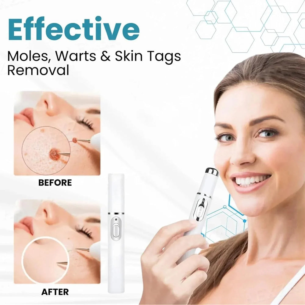 Non-Invasive Mole and Wart Removal Pen Cosmia.pk