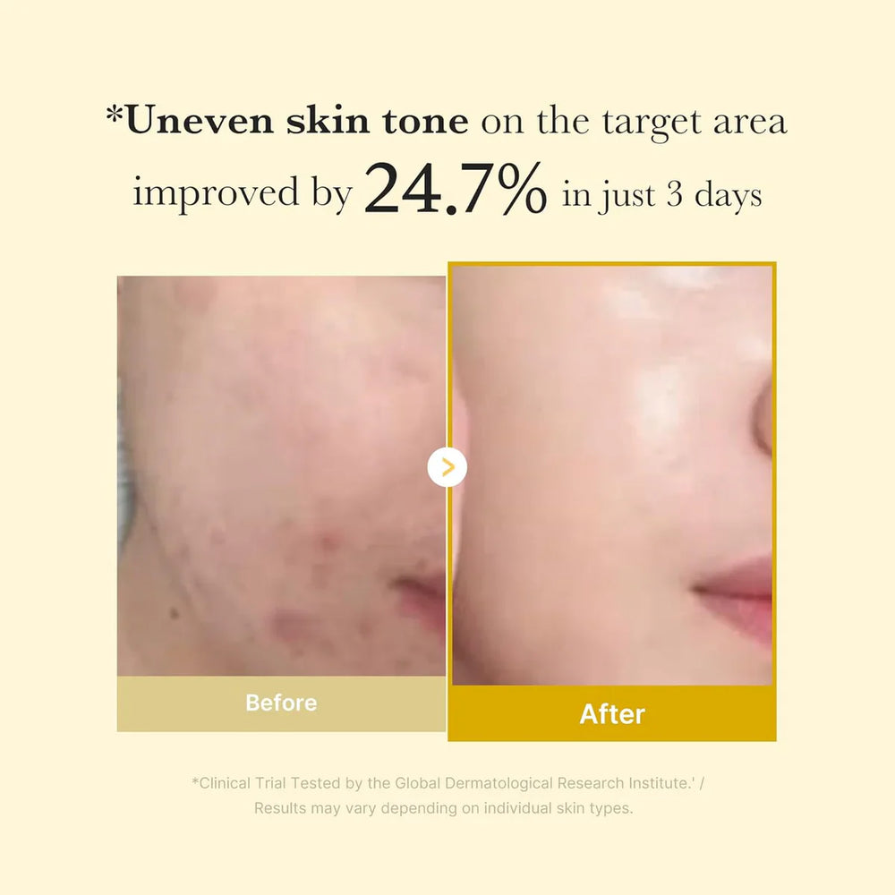 Medicube Kojic Acid Turmeric Night Wrapping Mask - 75ml Medicube
