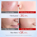 Sadoer Snail Collagen Amino Acid Facial Claenaser 100g