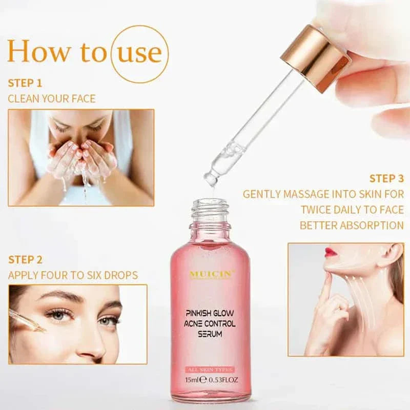Muicin V9 Pinkish Glow Anti Acne Face Serum – 15ml Muicin
