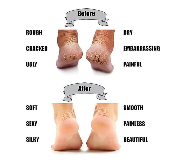 Anti Crack Silicone Gel Heel & Foot Protector Cosmia.pk