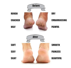 Anti Crack Silicone Gel Heel & Foot Protector Cosmia.pk