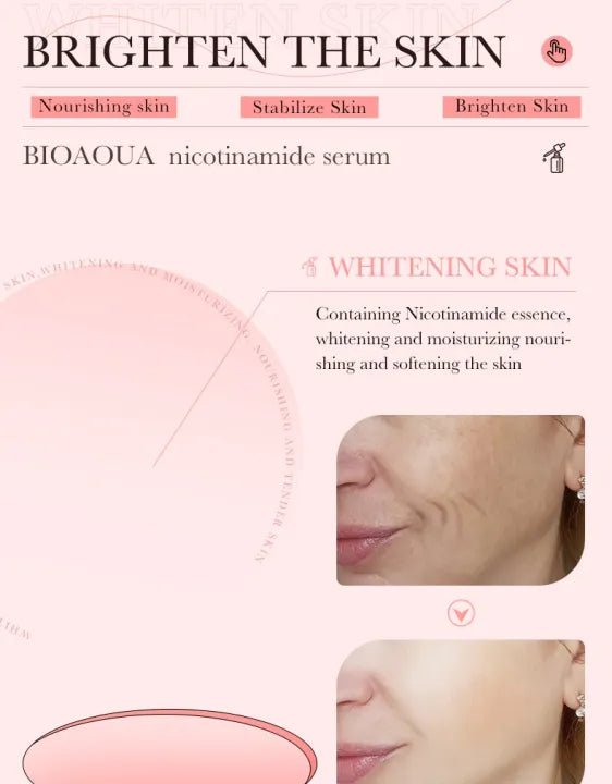 BIOAQUA Dispel Frekle Stable Soothing Nicotinamide Serum- 30ml Bioaqua
