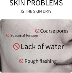 Oyax Rice Whitening and Brightening Facial Mask - 10 PCS Oyax