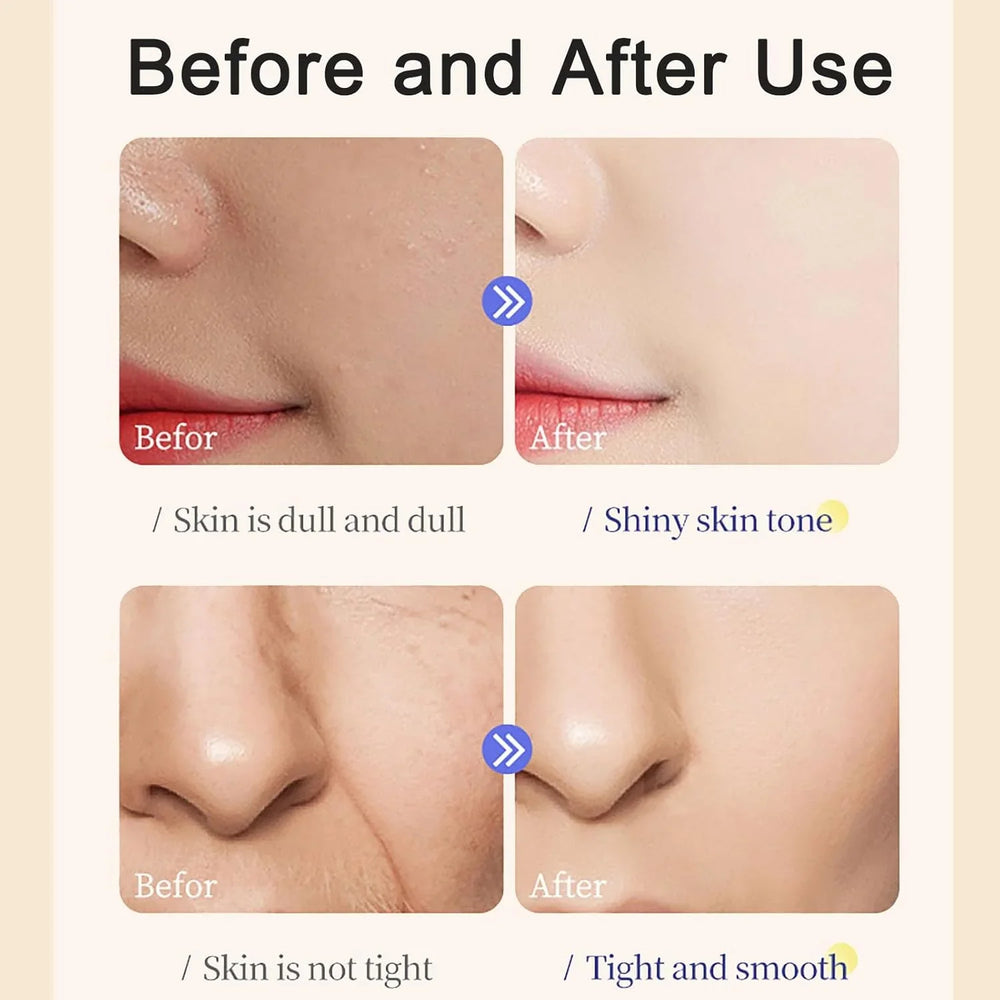 Oyax Rice Whitening and Brightening Facial Mask - 10 PCS Oyax