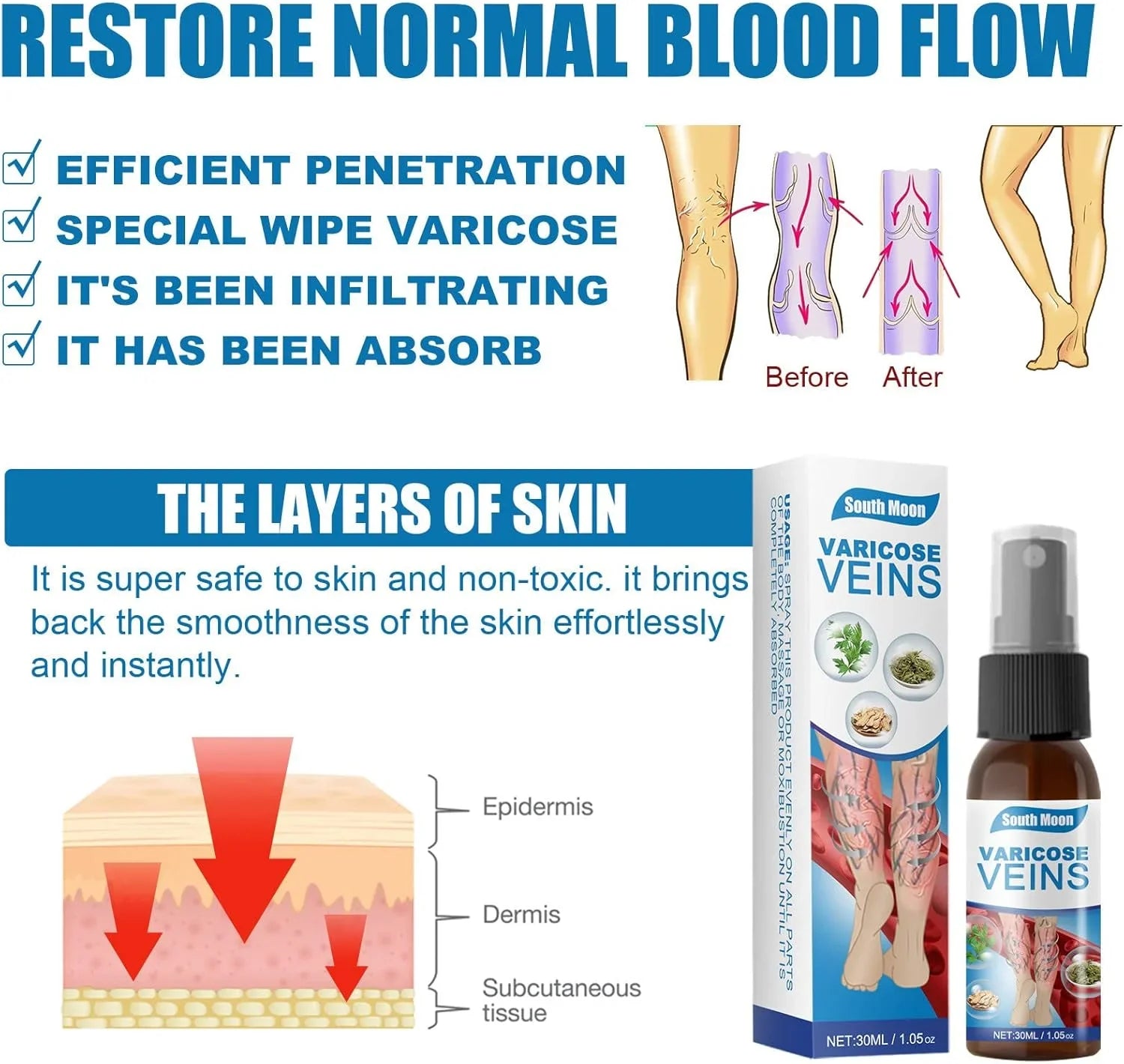 South Moon Vein Healing Varicose Veins Treatment Spray - 30ml South Moon
