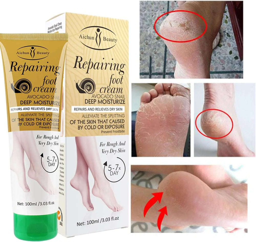 AICHUN BEAUTY Repairing Foot Cream - 100g Aichun Beauty