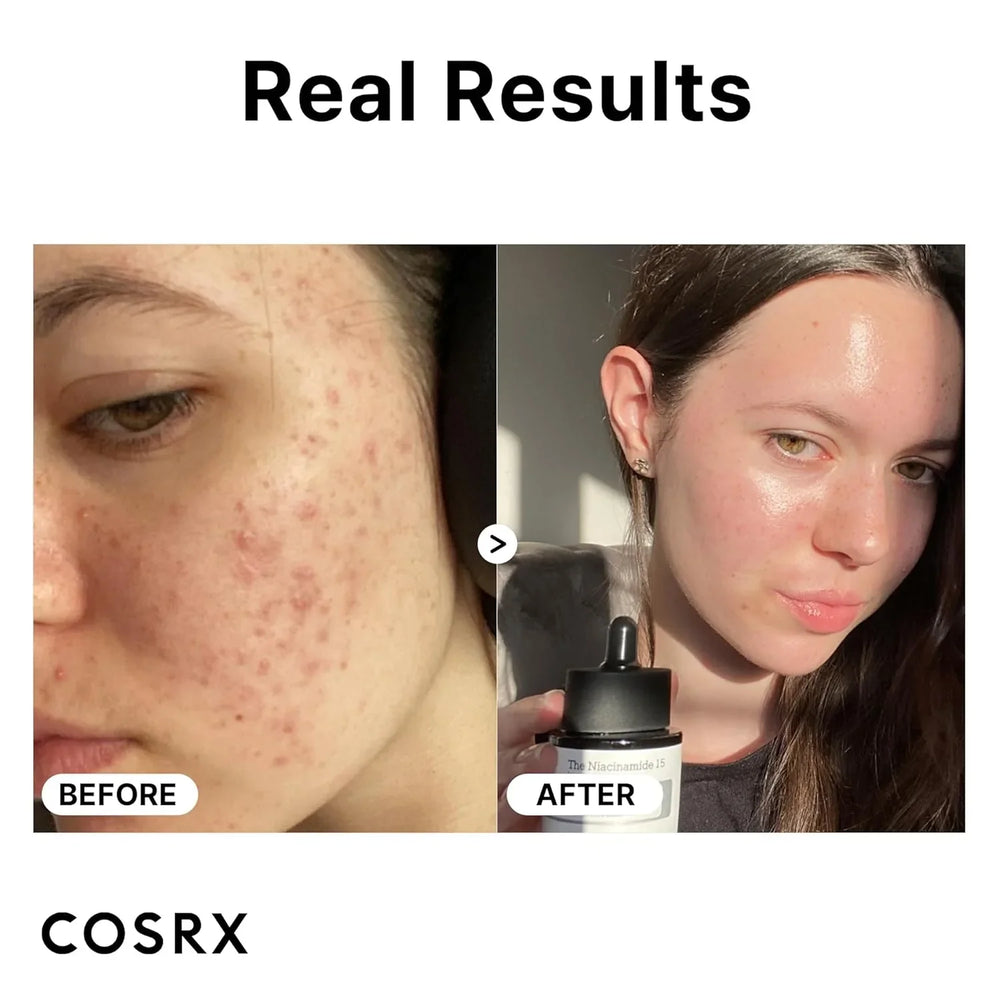 COSRX Niacinamide 15% Face Serum - 20ml Cosrx