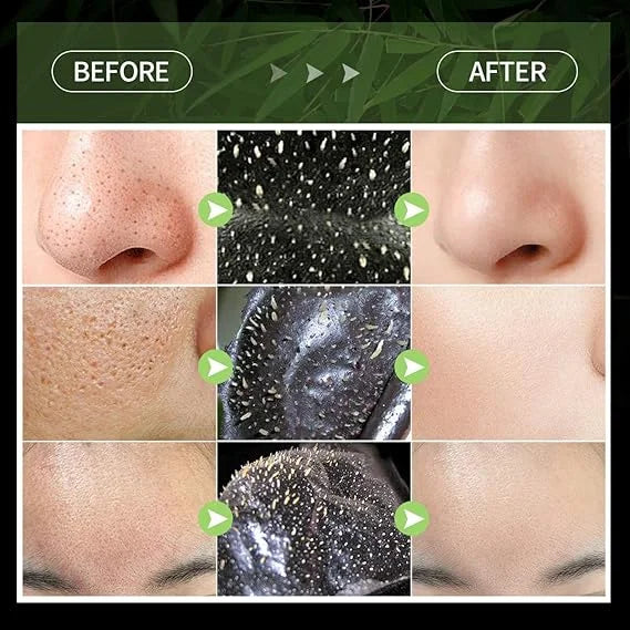 CHIRS'S UK Blackhead Peel Off Face Mask - 80g Chirs's