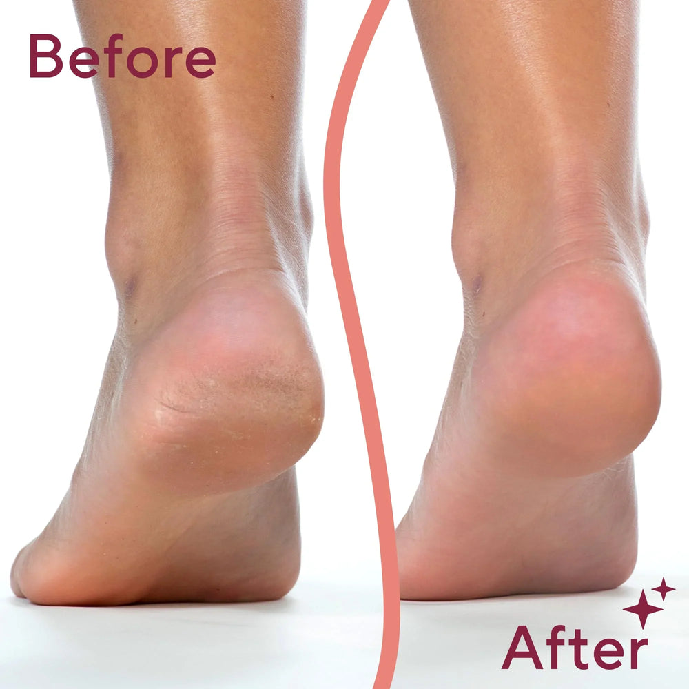 Flawless Pedi electronic pedicure tool Flawless
