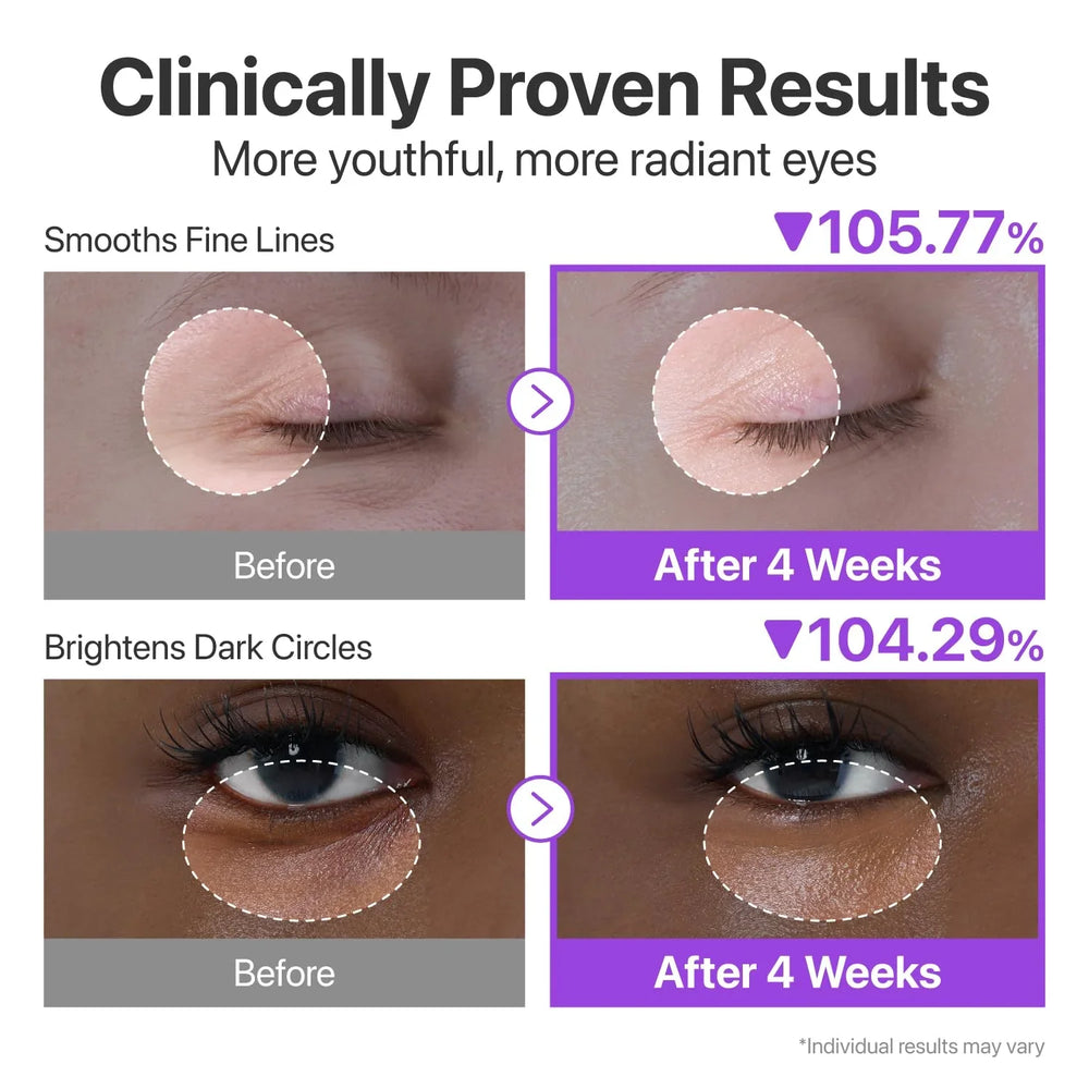 NUMBUZIN No.9 NAD+ Retinol Volumetox Eye Cream - 10ml Numbuzin