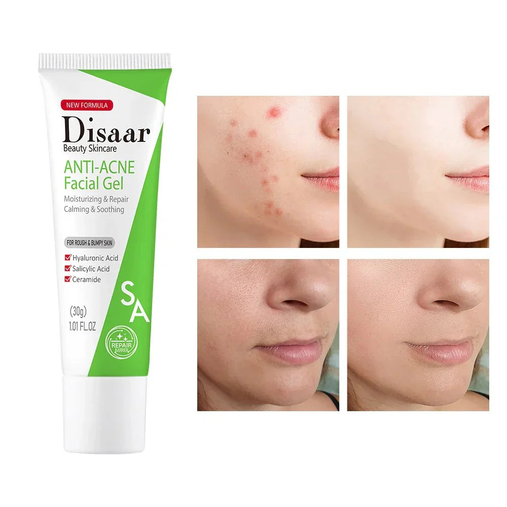 Disaar ceramide Anti-Acne Facial Gel Moisturizing Face Gel - 30g Disaar