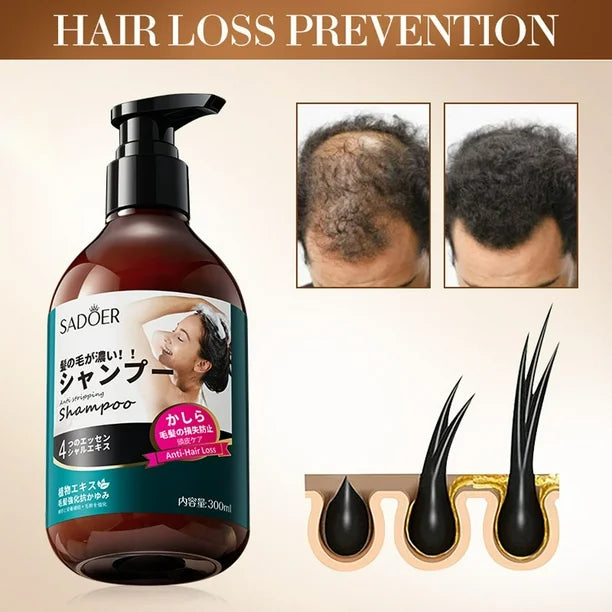 SADOER Anti Hair Loss Shampoo Anti-dandruff Hair Growth Shampoo - 300ml Sadoer