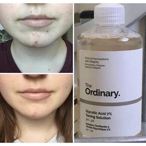 The Ordinary Glycolic Acid 7% Toning Solution - 240ml The Ordinary