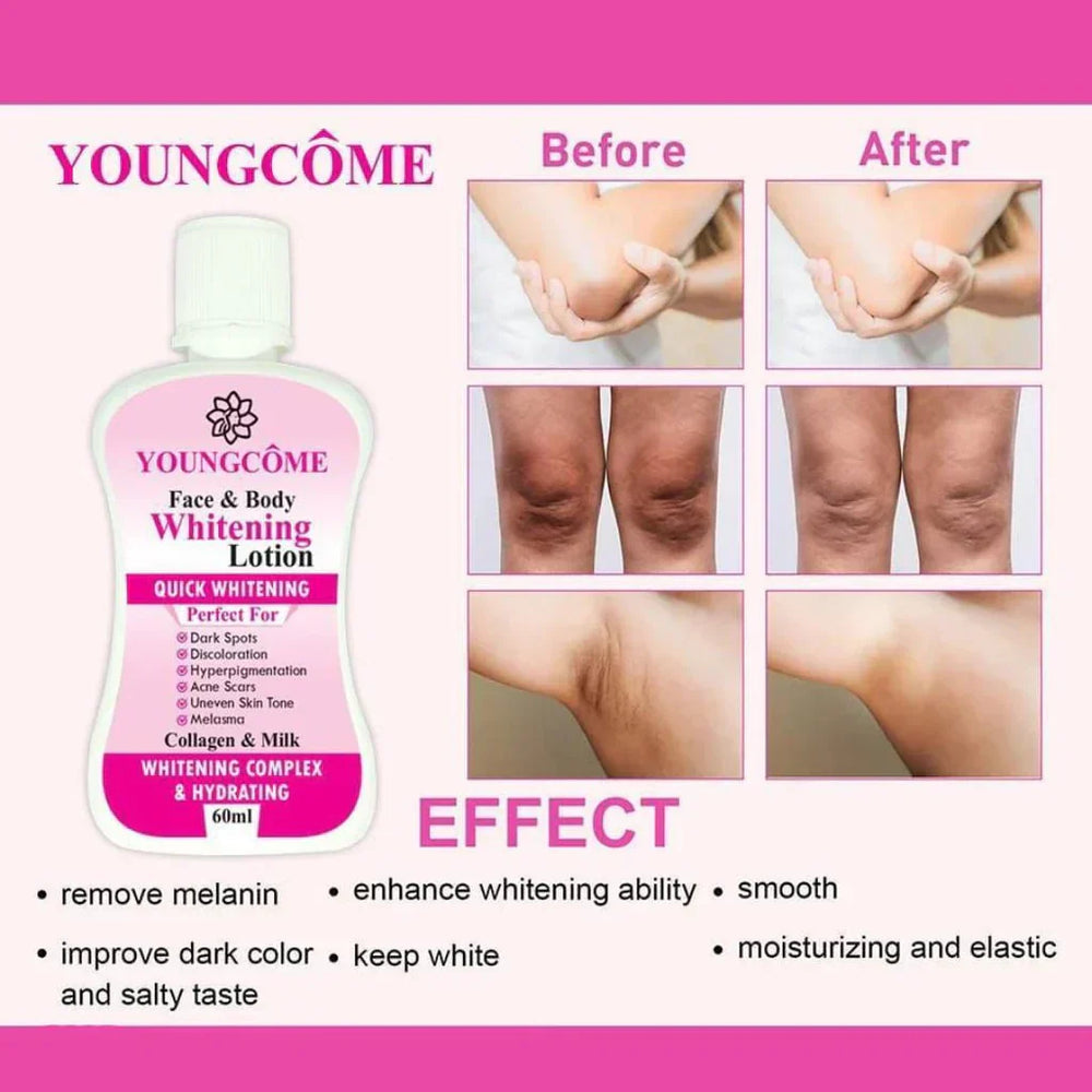 Youngcome Face & Body Whitening Lotion – 60ml Youngcome