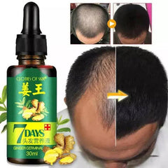 7 Days Hair Growth Germinal Serum - 30ml 7 Days