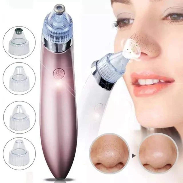 Rechargeable Blackhead Remover Machine Cosmia.pk