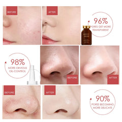 MUICIN - Shrink Pores Hyaluronic Acid Serum - 30ml Muicin