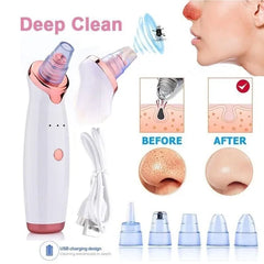 5-in-1 Multi-functional Blackhead Removal Device Cosmia.pk