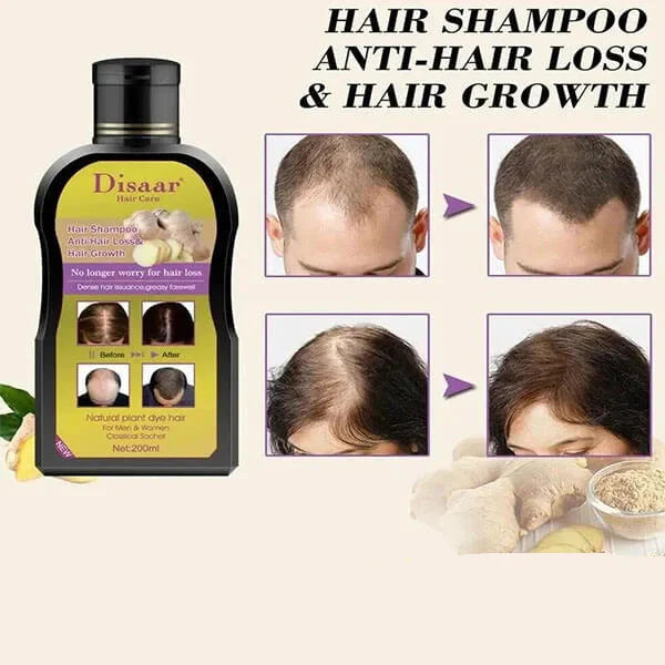 DISAAR Ginger Hair Shampoo Anti-Hair Loss – 200ml Disaar