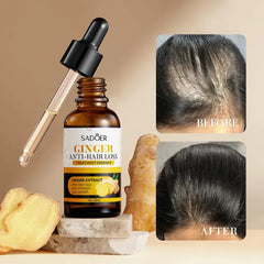 Sadoer Ginger Anti-Hair loss Treatment Oil Sadoer