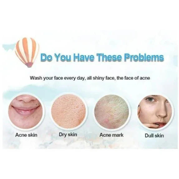 Bioaqua Acne Removal Cream Spot-Free Skin - 30g Bioaqua