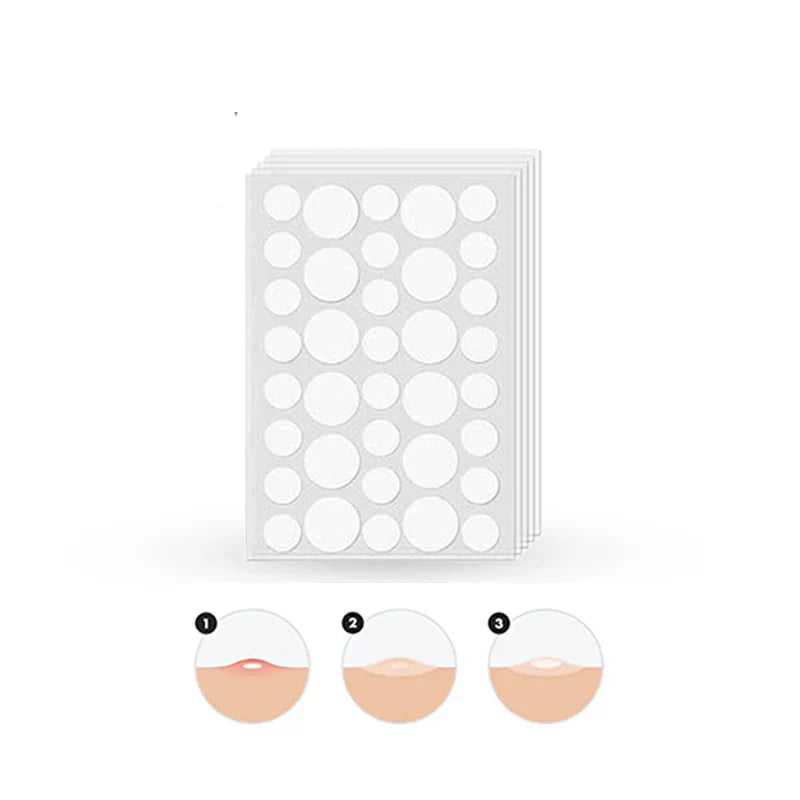 Glamorous Face Acne Pimple Patch 72 Patches Glamorous Face