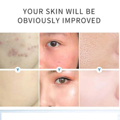 AICHUN BEAUTY Salicylic Acid Purifying Shrink Pores Exfoliation Aichun Beauty